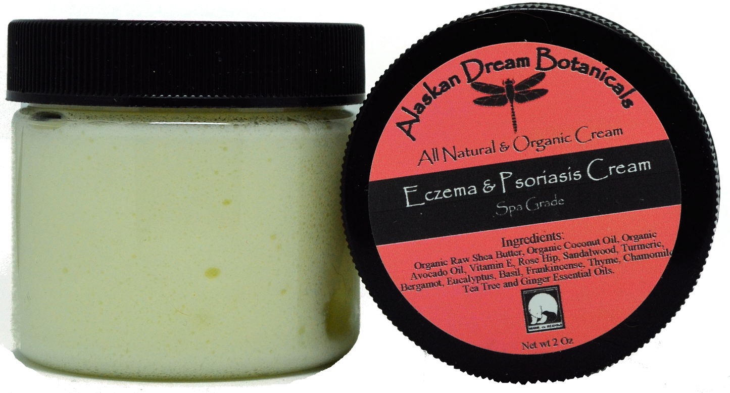 
                  
                    Eczema & Psoriasis Cream - Alaskan Dream Botanicals
                  
                