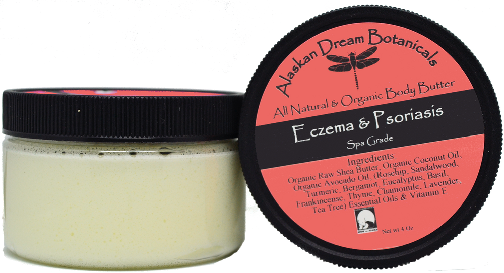 Eczema & Psoriasis Cream - Alaskan Dream Botanicals